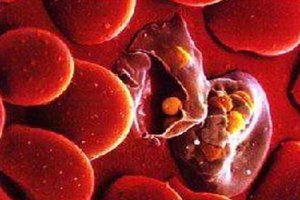 世界十大致命传染病 疟疾有极强致癌性潜伏时间长